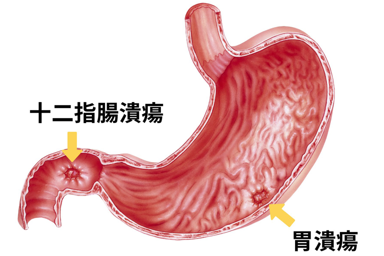 右 の 脇腹 が 痛い