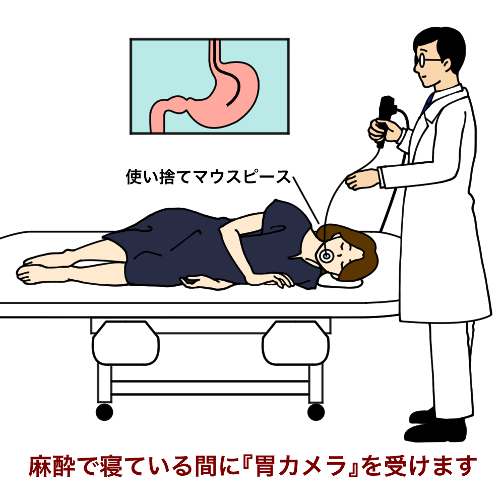 下剤を飲まない大腸内視鏡 夙川内視鏡内科まえだクリニック 西宮市で痛くない胃カメラ 下剤を飲まない大腸カメラを土曜日曜も実施