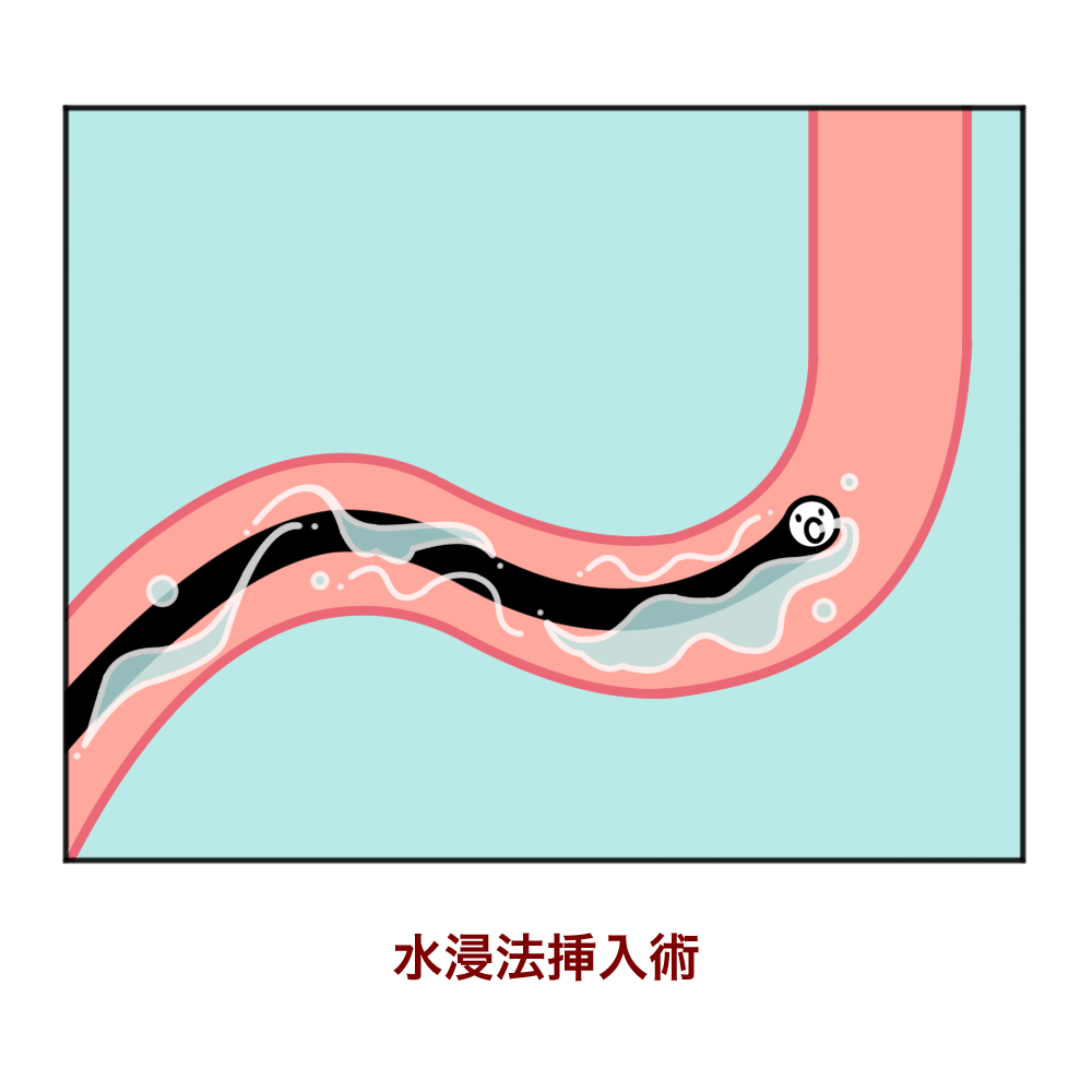 下剤を飲まない大腸内視鏡 夙川内視鏡内科まえだクリニック 西宮市で痛くない胃カメラ 下剤を飲まない大腸カメラを土曜日曜も実施